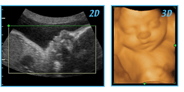 That S My Baby Ultrasound 3d 4d In Bowie Maryland